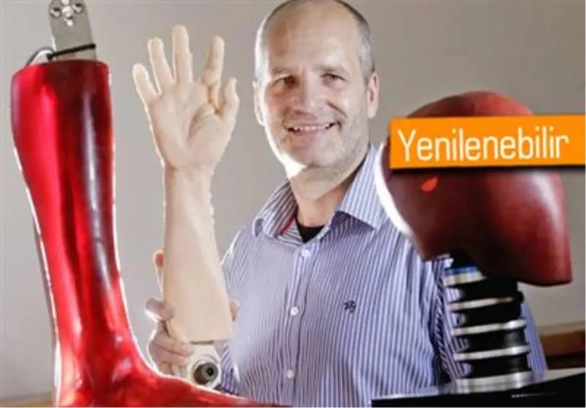 Kesilen Kol Yeniden Çıkabilir