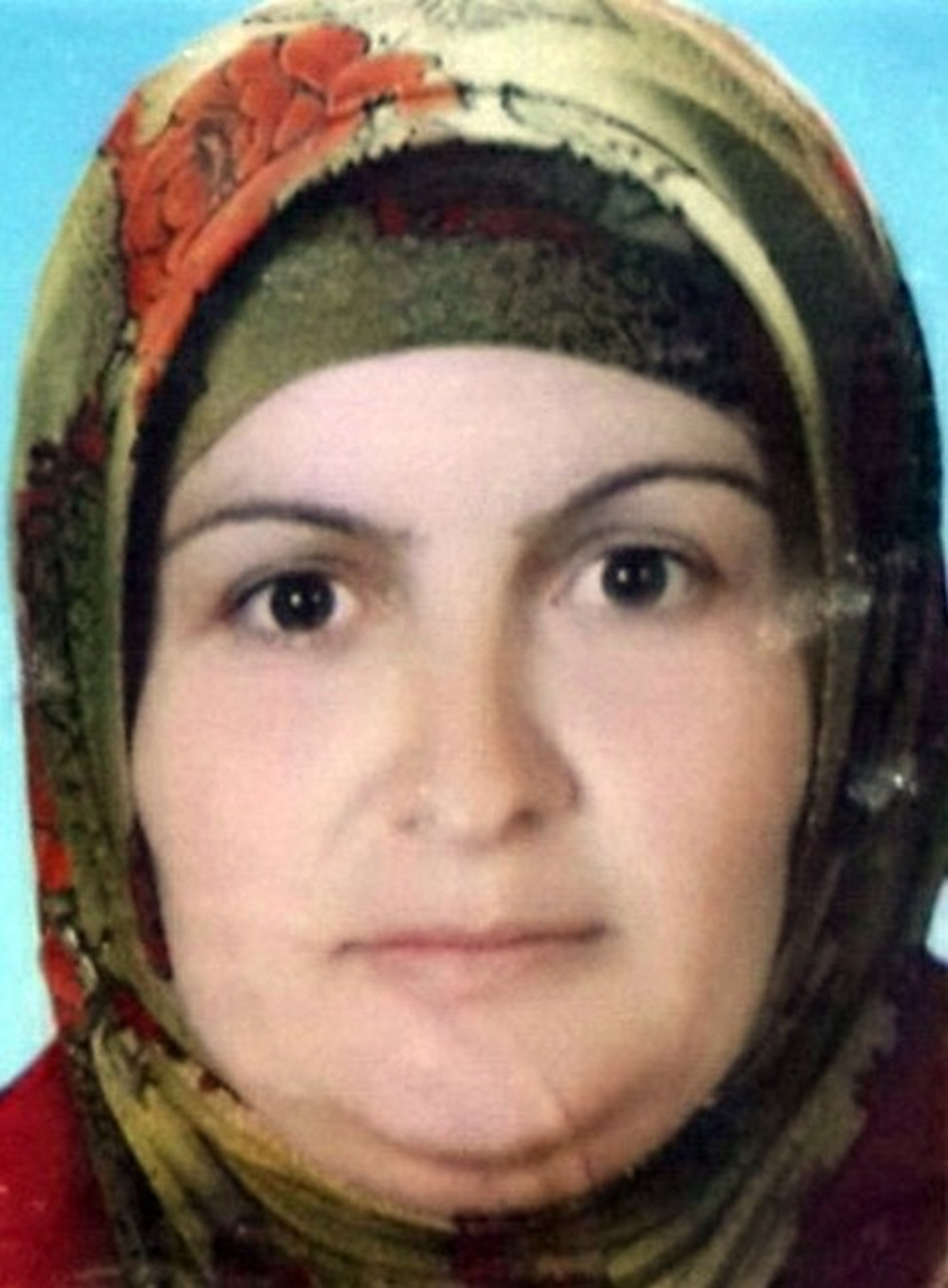 Anevrizma Nedeniyle Hayatını Kaybetti