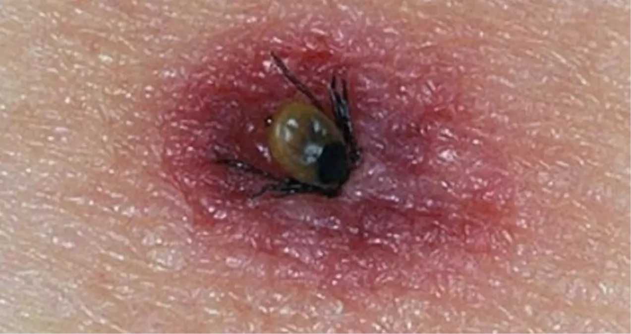 Isparta\'da Kenenin Isırdığı Çoban Yaşamını Yitirdi