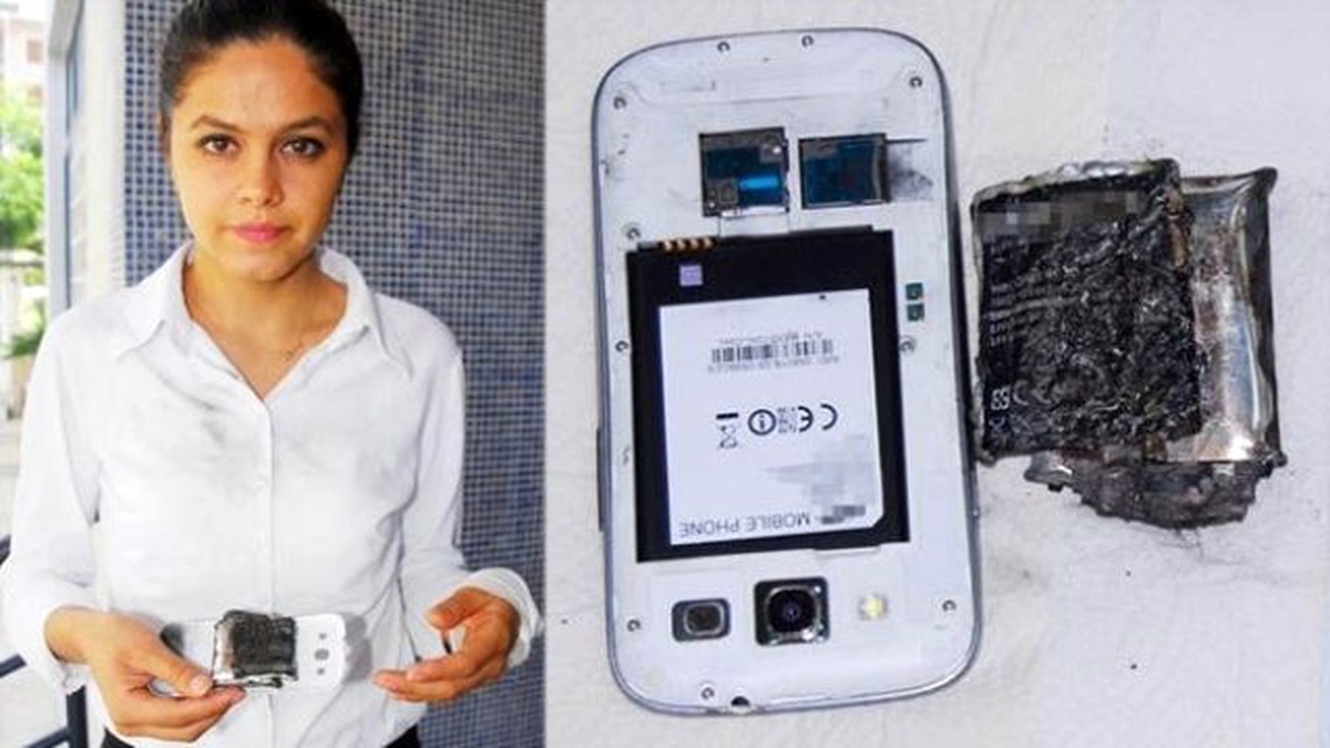 Konuşurken Elindeki Cep Telefonu Patladı