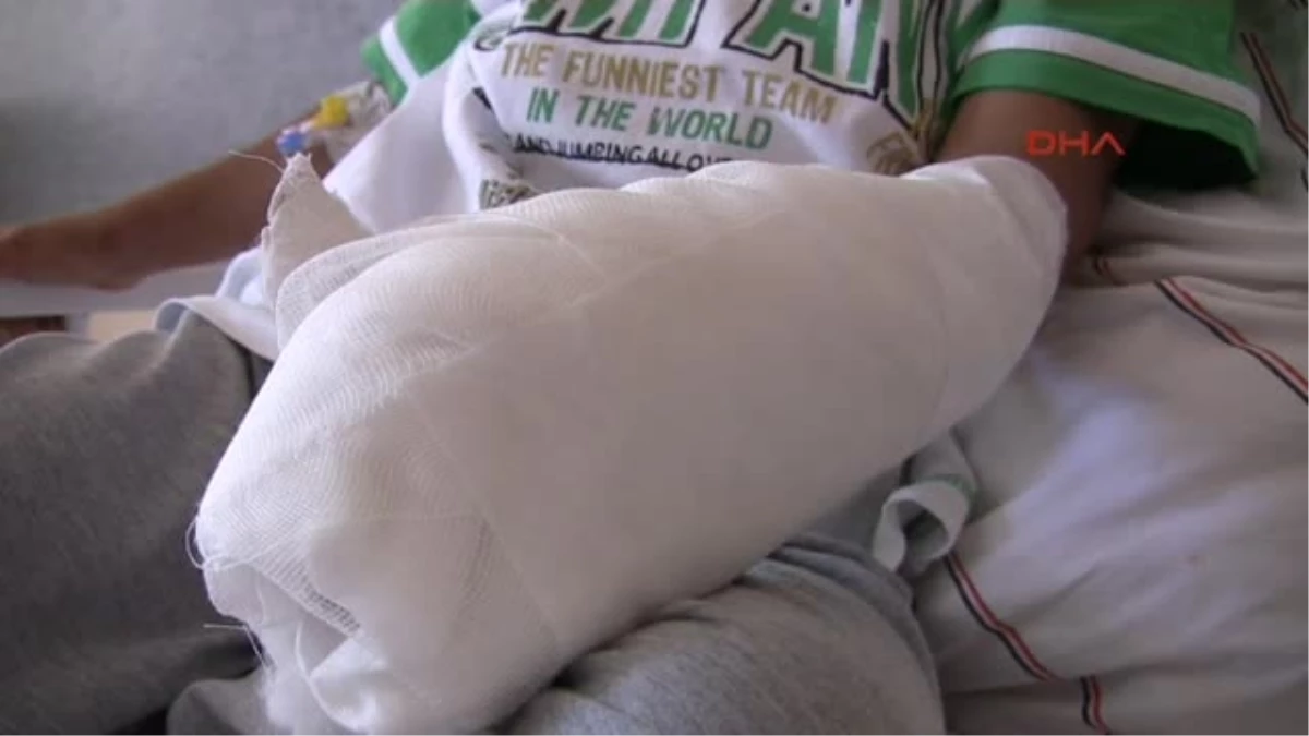 Köstebek Tabancası Elinde Patlayan Çocuk Yaralandı