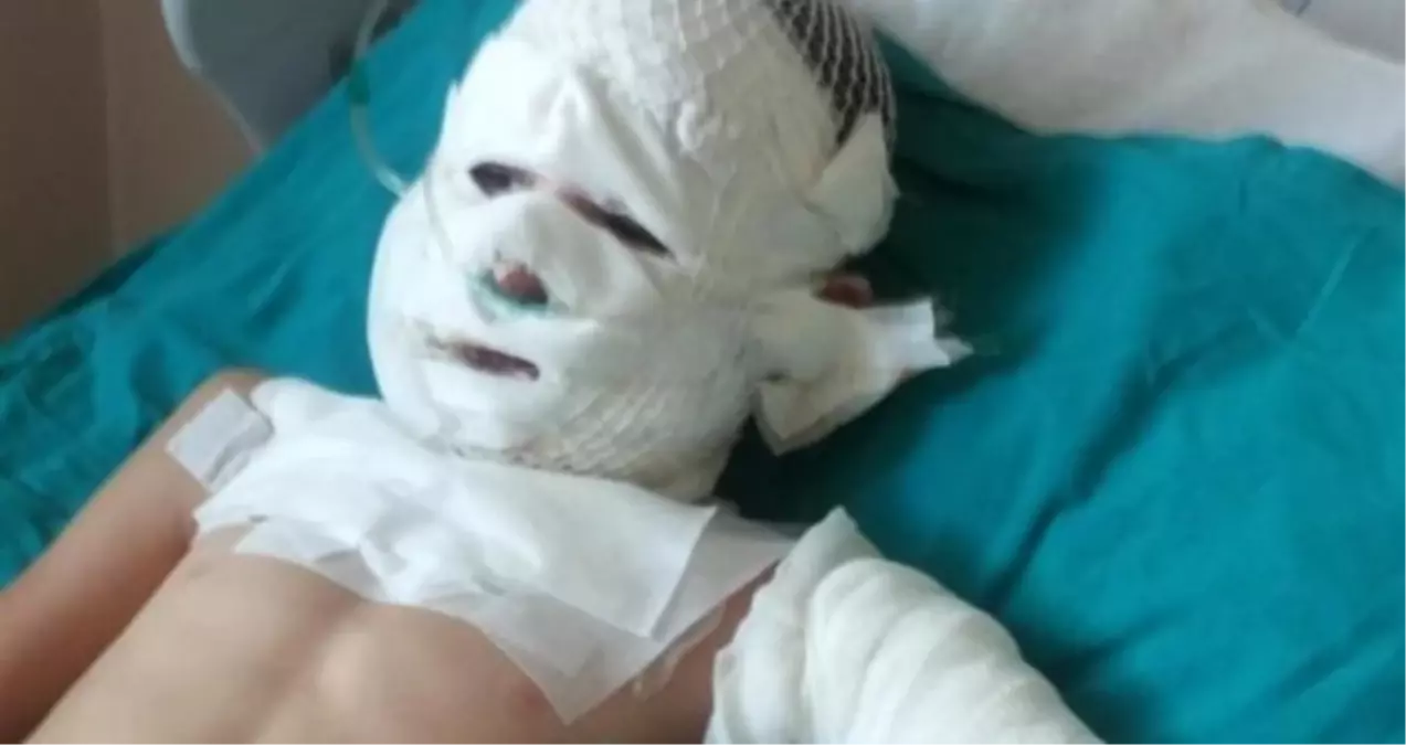 İftar İçin Atılan Ses Bombası, Parkta Oynayan Yusuf'un Elinde Patladı