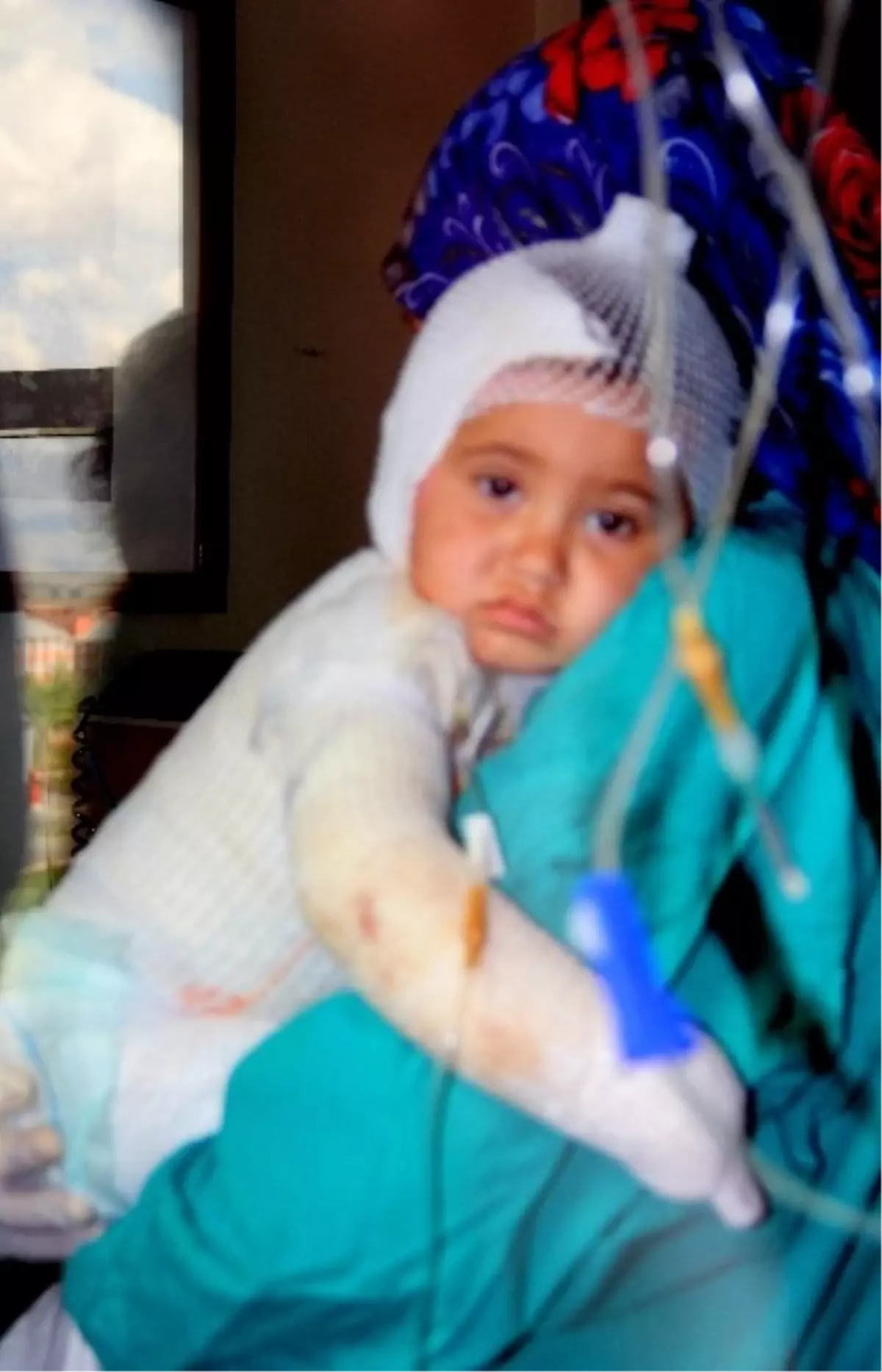 Tandıra Düşen Çocuk Feci Şekilde Yandı