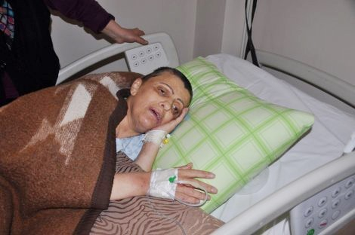 Tartıştığı Arkadaşı Tarafından Başından Vurulan Kadın: "Kazayla Vuruldum"