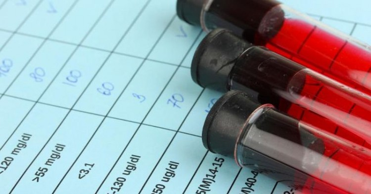 Alzheimer\'a Çözüm Olabilecek Yeni Kan Testi !