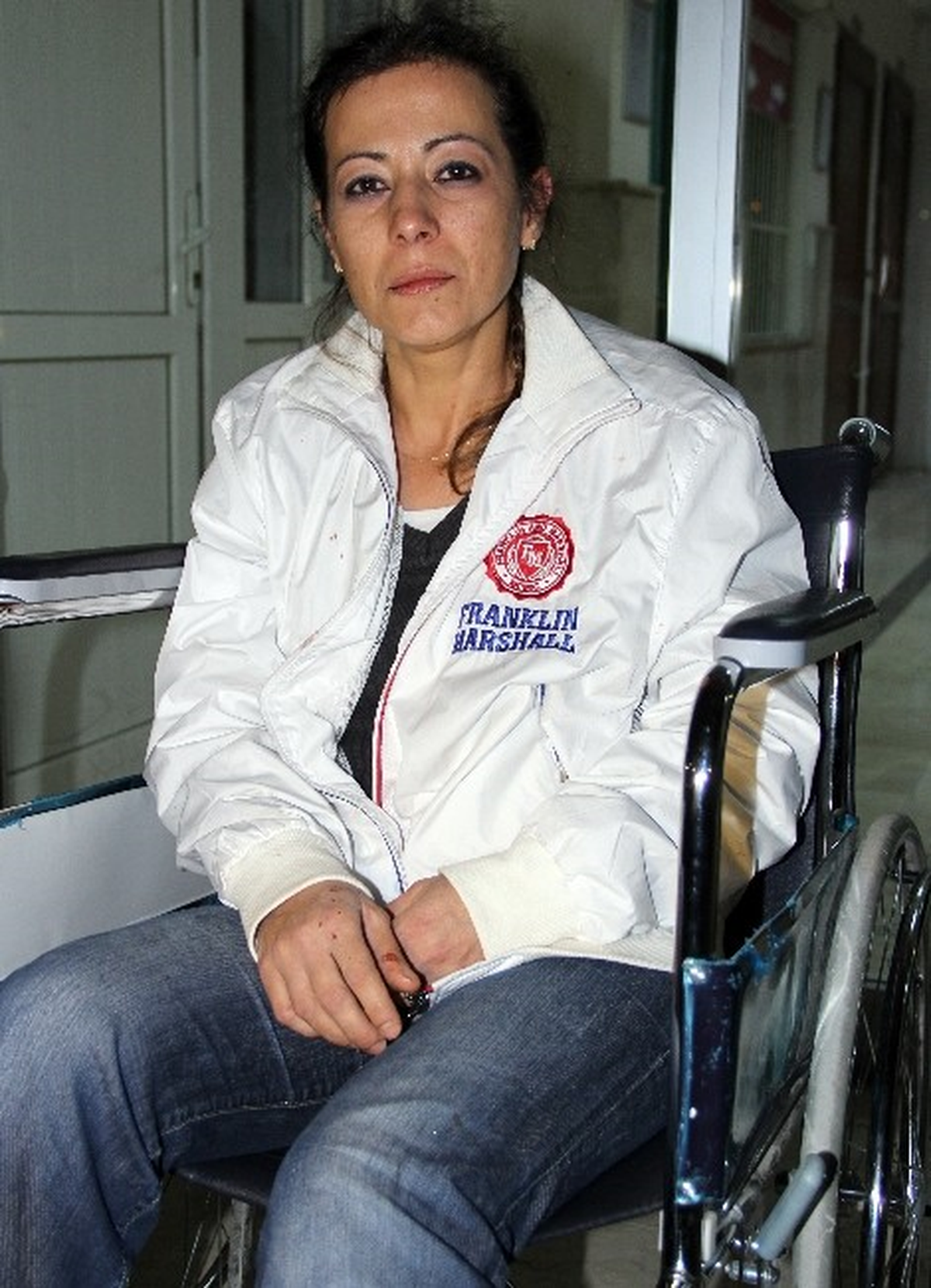 Eski Sevgilisinin Burnunu Kıran Şahsa 11 Yıl 8 Ay Hapis Cezası