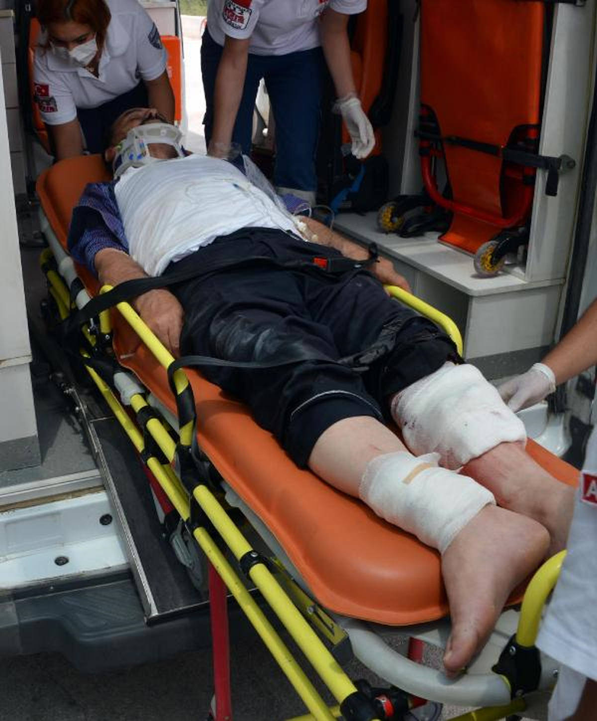 Nikahsız Eşini Satırla Yaraladı, Öldüğünü Düşünerek 4\'üncü Kattan Atladı