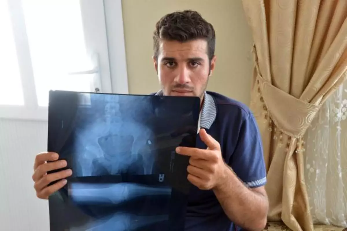 Ahmed'i Felç Eden Polise 7 Bin 500 Lira Para Cezası