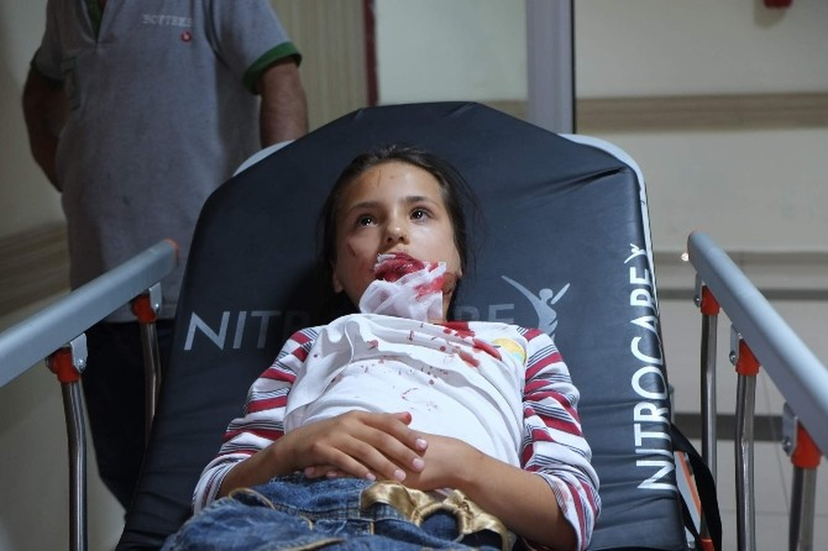 Yüksekten Düşen Çocuk Yaralandı