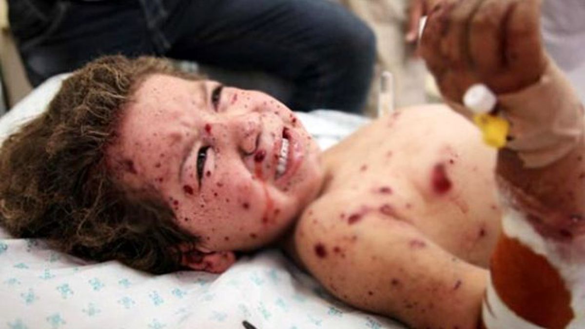 İsrail Donanması Sahili Vurdu, 4 Çocuk Öldü