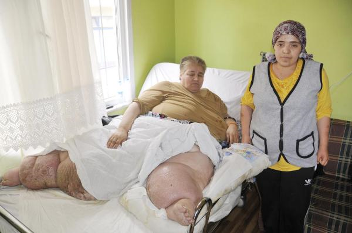 400 Kiloluk Fil Hastası Yardım Bekliyor