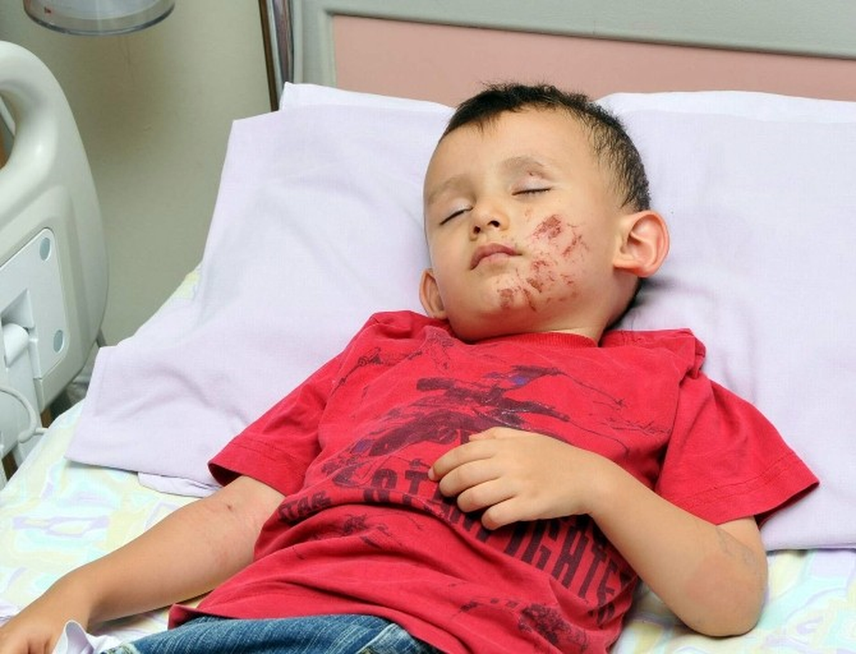 Üçüncü Kattan Düştü, Burnu Bile Kanamadı