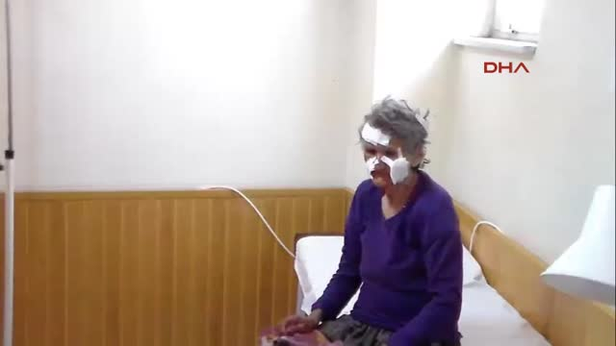 Köpeğin Saldırdığı Kadın, Hastanelik Oldu