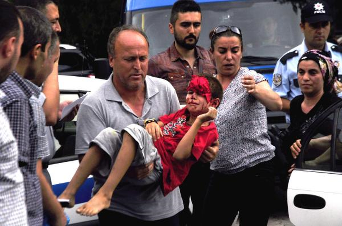 Üzerine Demir Kapı Düşen 8 Yaşındaki Arda Yaralandı
