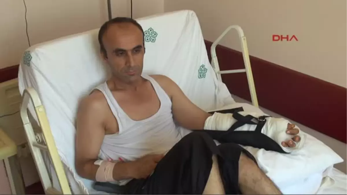 Pres Makinasında Bileğinden Kopan Sol Eli Geri Dikildi