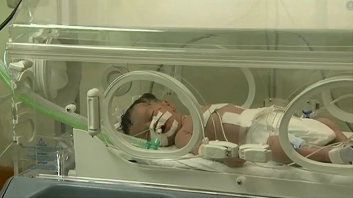 Gazze\'de Ölen Annesinin Karnından Sezeryanla Alınan Bebek Öldü