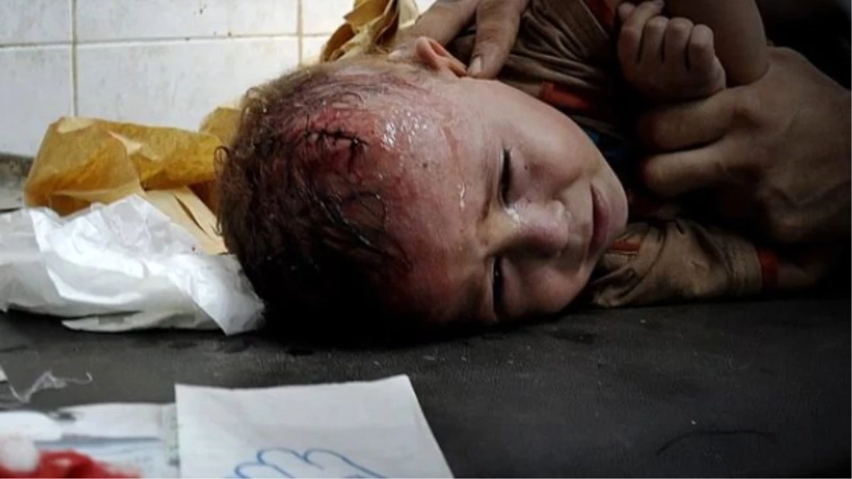 AA, Gazze\'deki Çocuk Katliamını Belgesel Yaptı