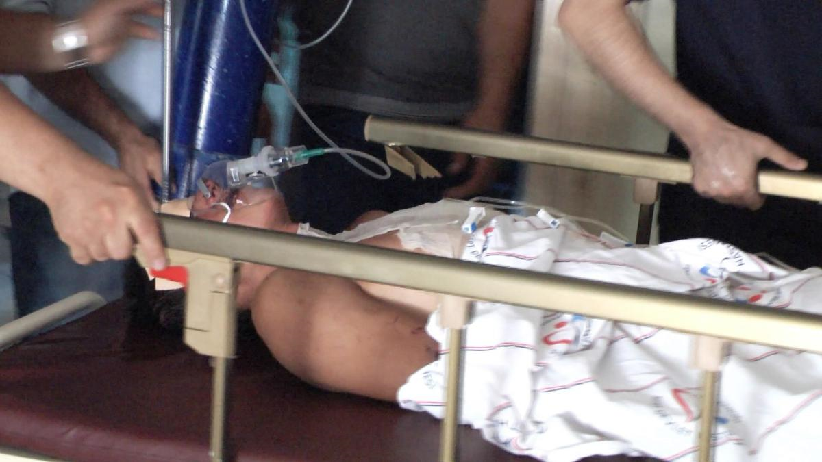 Güneşe Bırakılan Tiner Kutusu Alev Aldı: 4 Yaralı