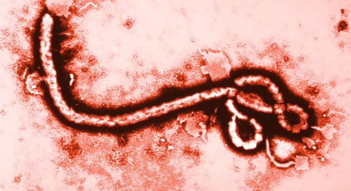 Bulgaristan\'dan "Ebola Virüsü" Yok Açıklaması