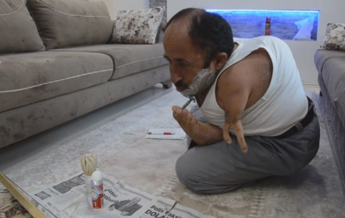 49 Yıldır Ayaklarını Elleri Yerine Kullanıyor