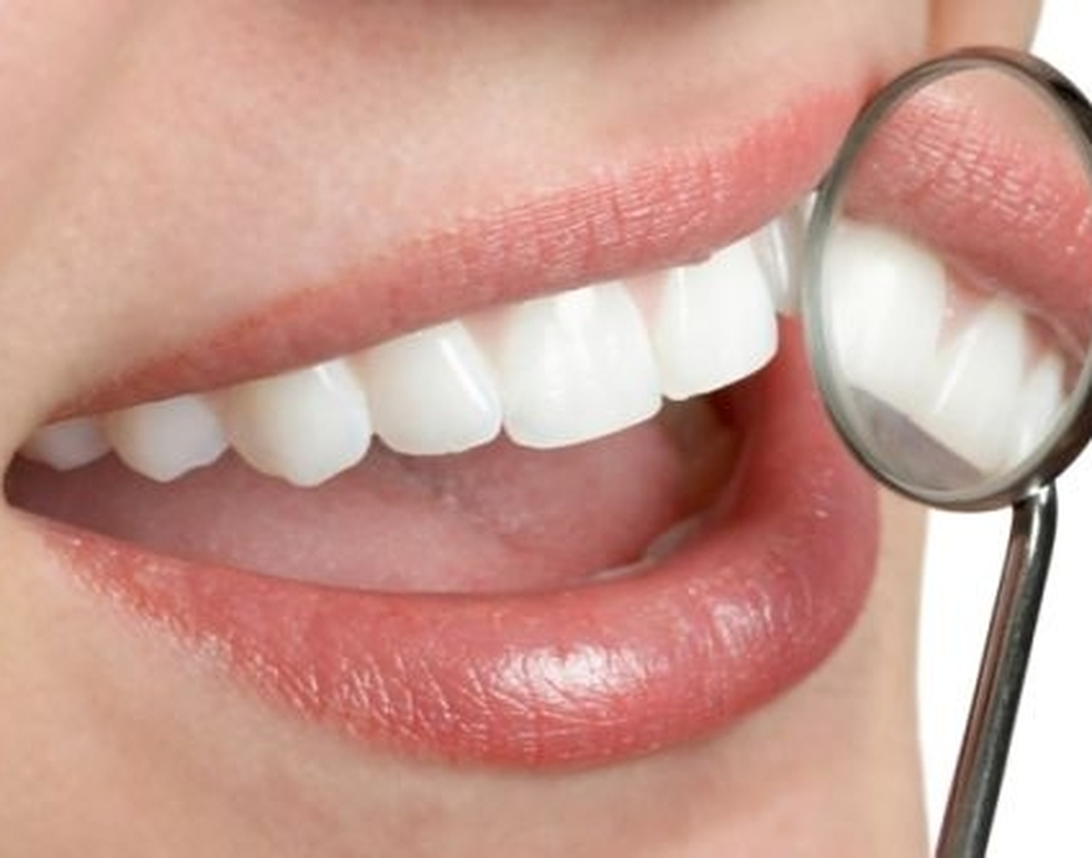 Kadınlar diş bakımı için yaz mevsimini tercih ediyor