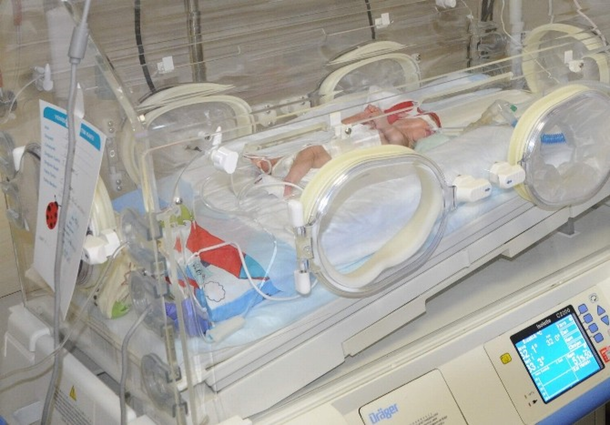 26 Haftalık \'Akyıldız Bebeğin\' Yaşama Tutunma Mücadelesi