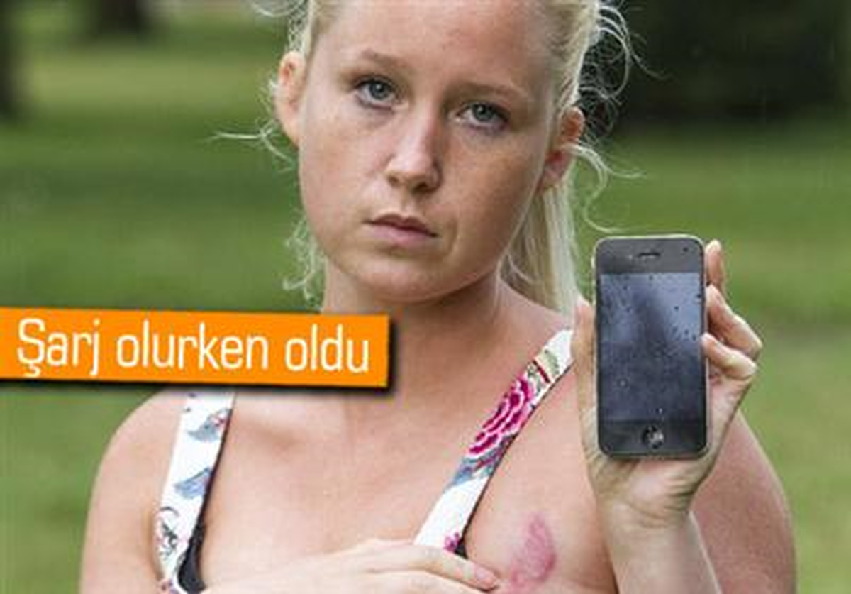 Uyurken İphone\'u Aşırı Isındı, Genç Annenin Göğsü Yandı
