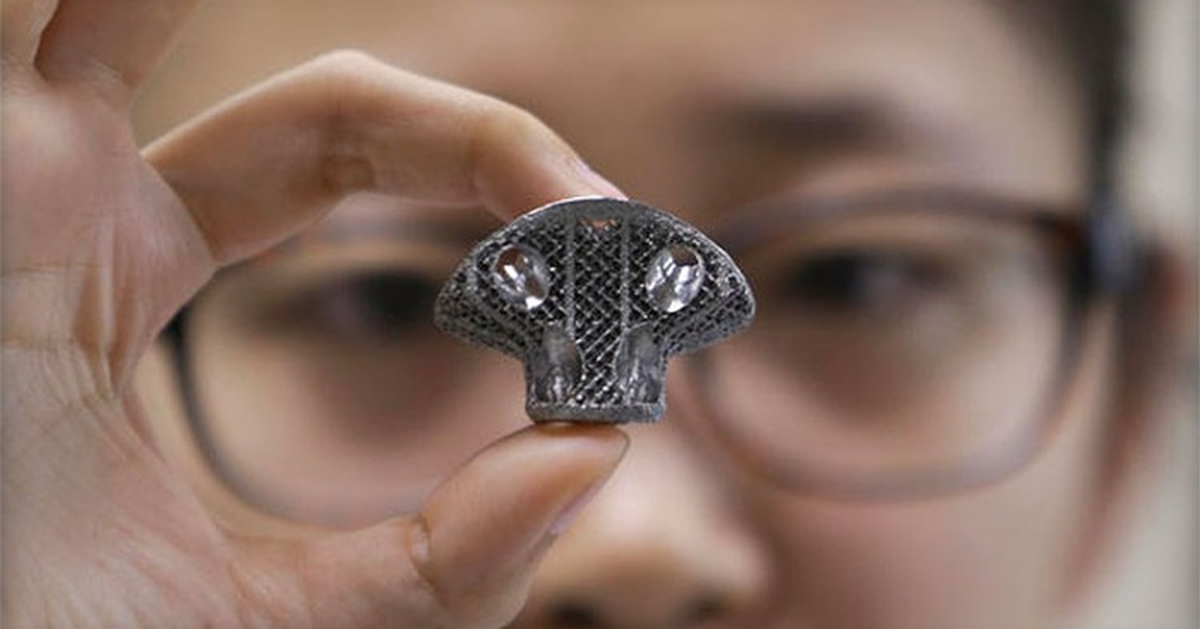 Omurga Ameliyatında 3D Yazıcıdan Çıkma Parça Kullanıldı