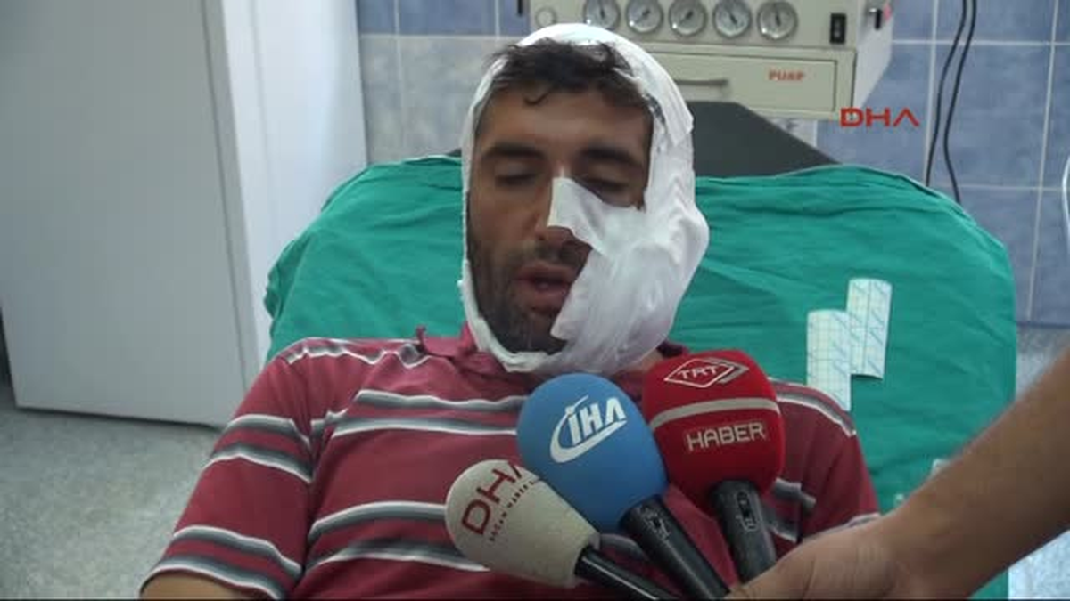 Sivas\'ta Kurt Saldırısına Uğrayan 6 Kişi Yaralandı