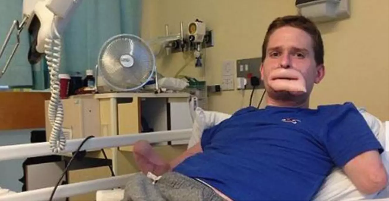 Sonunda Yeni Dudaklarına Kavuştu