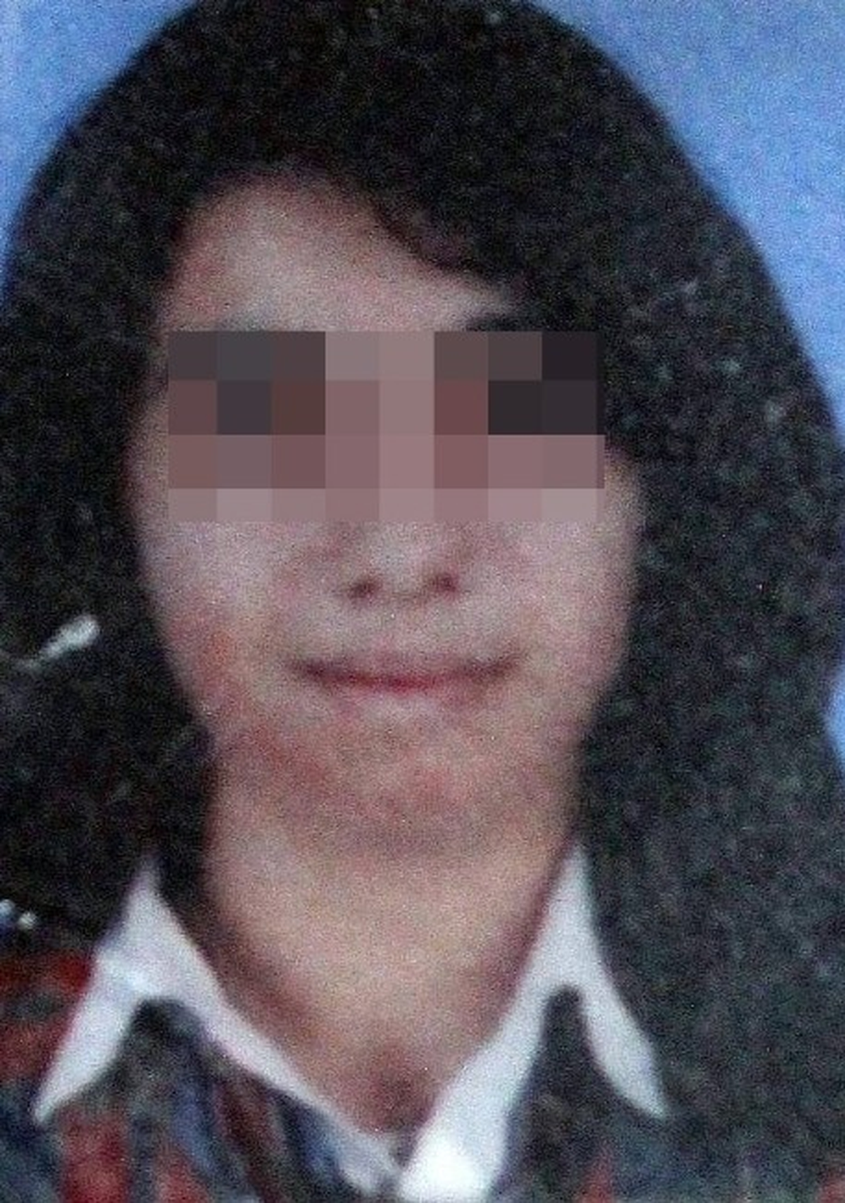 Genç Kız, Yüzündeki Yanık İzi Yüzünden Ölüme Atladı
