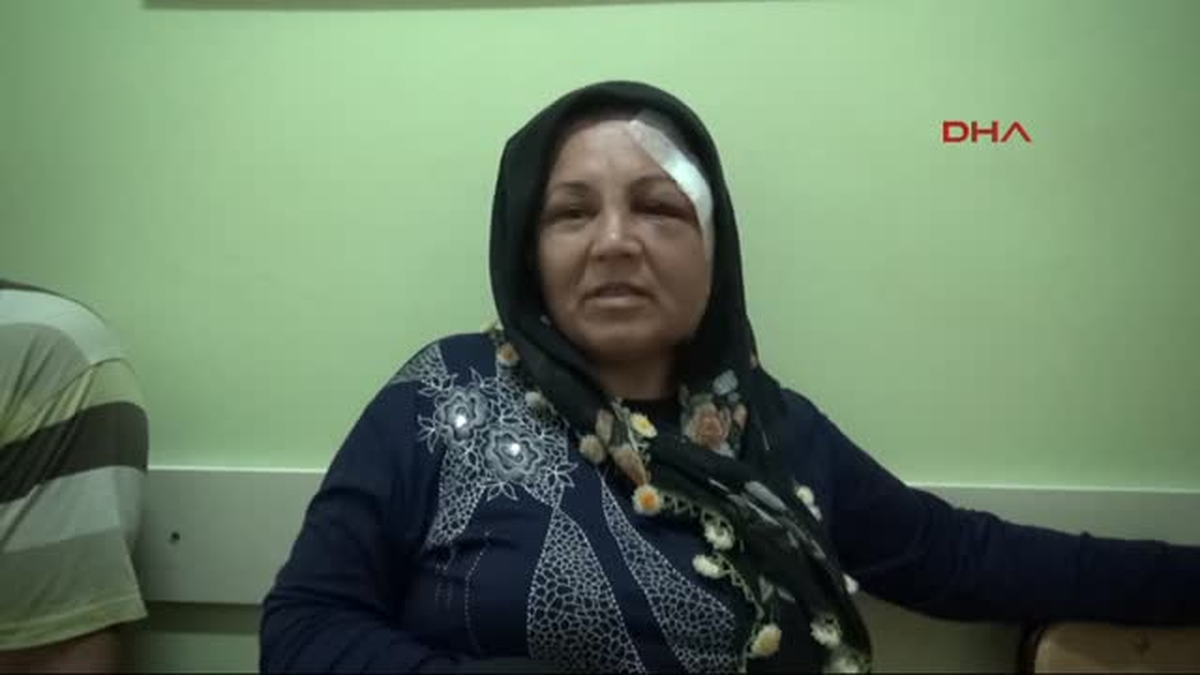 Kayınbiraderi Elmacık Kemiğini Kırdı