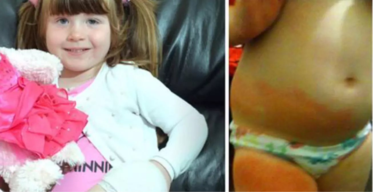 4 Yaşındaki Kızı Zehirli Örümcek Isırdı!