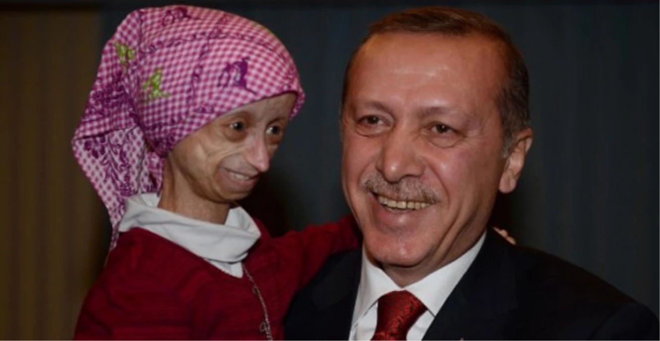 Progeria Hastası Çocuklar, Cumhurbaşkanı Erdoğan\'ı Bekliyor