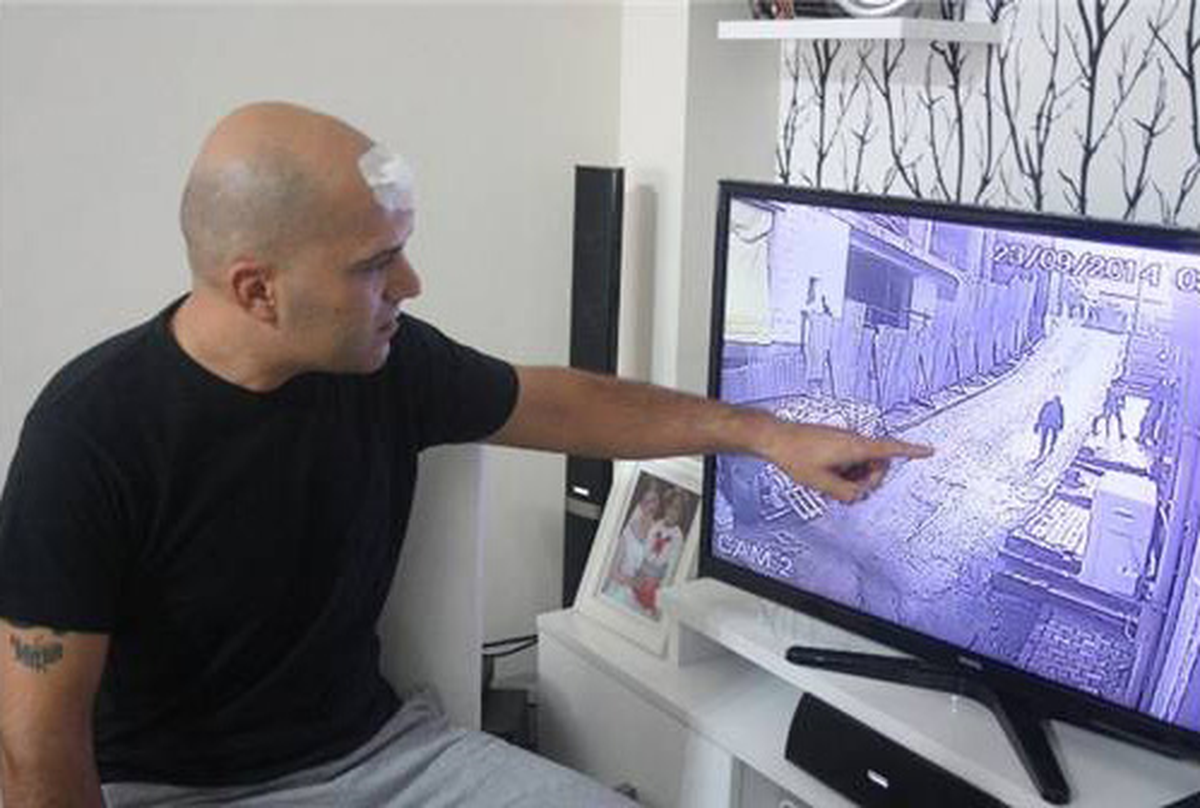 Yolda Yürürken Başına Kalas Düştü