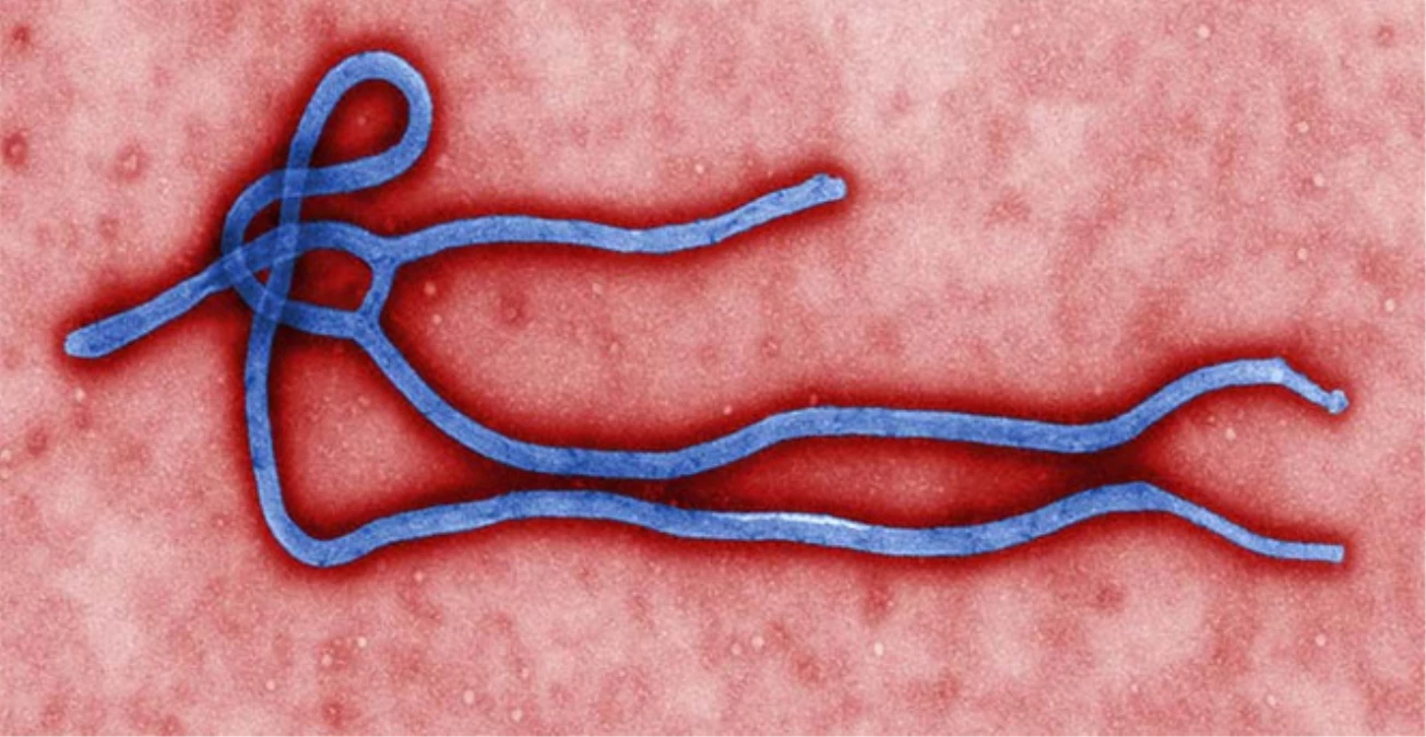 ABD\'de Ebola Virüsü Çıktı, İlaç Şirketlerinin Hisseleri Uçtu