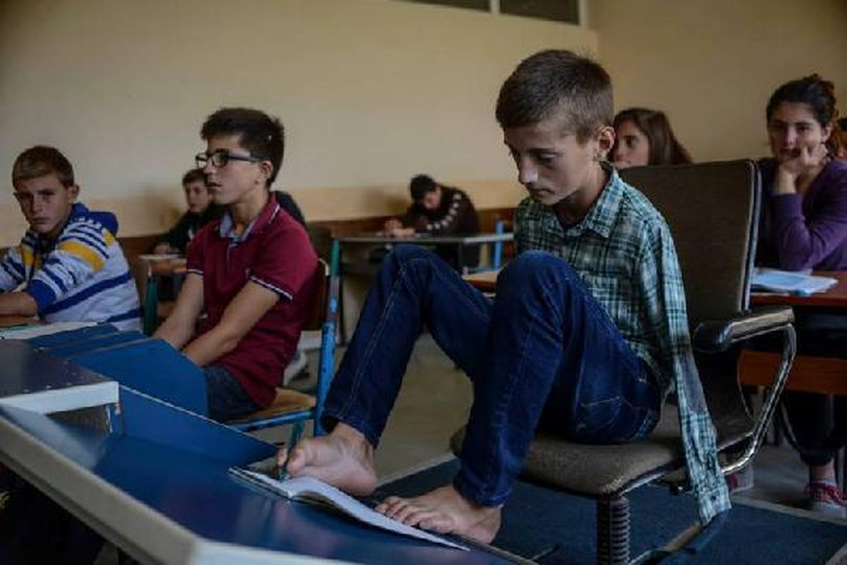 Doğuştan Engelli Kosovalı Öğrenci Okulun En Başarılısı
