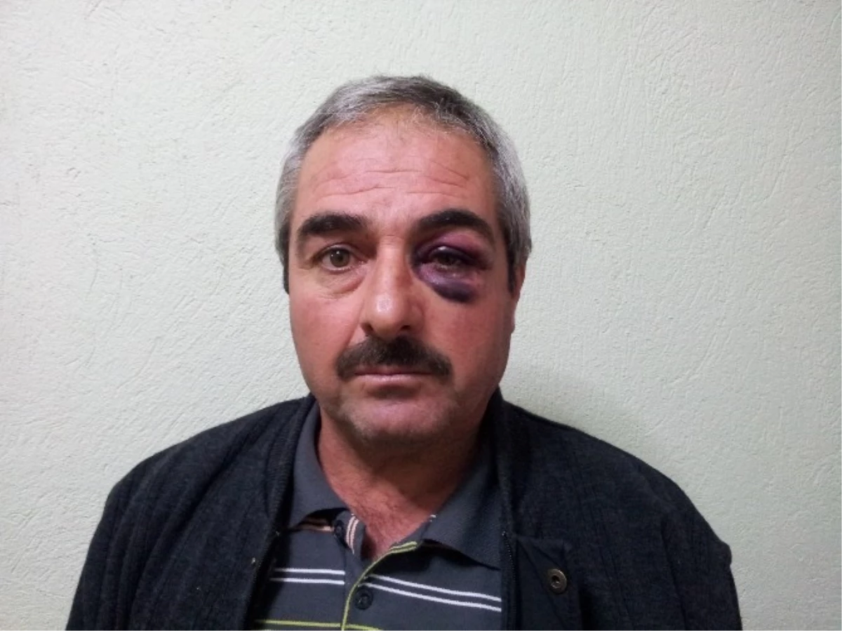 Karaman\'da Öğretmene Kerpetenle Saldırı