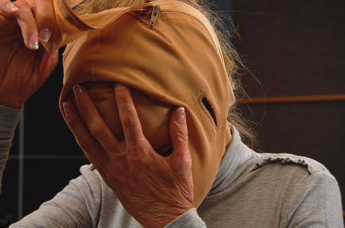 Yanan Yüzünü İlk Defa Göstermeye Hazırlanırken Aldığı Haberle Yıkıldı