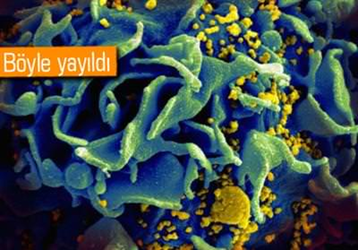 Bilim İnsanları Aıds\'in İlk Çıktığı Yeri Buldu