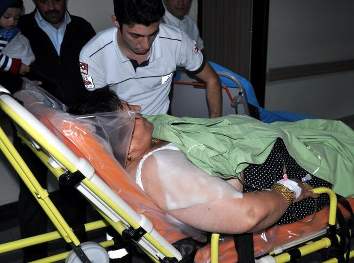 Yemek Yaparken Düdüklü Pencere Patladı: 1 Yaralı