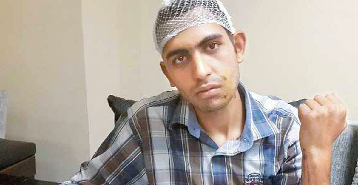 PKK'nın Kurban Eti Dağıtanları Katlettiği Görüntüler Ortaya Çıktı