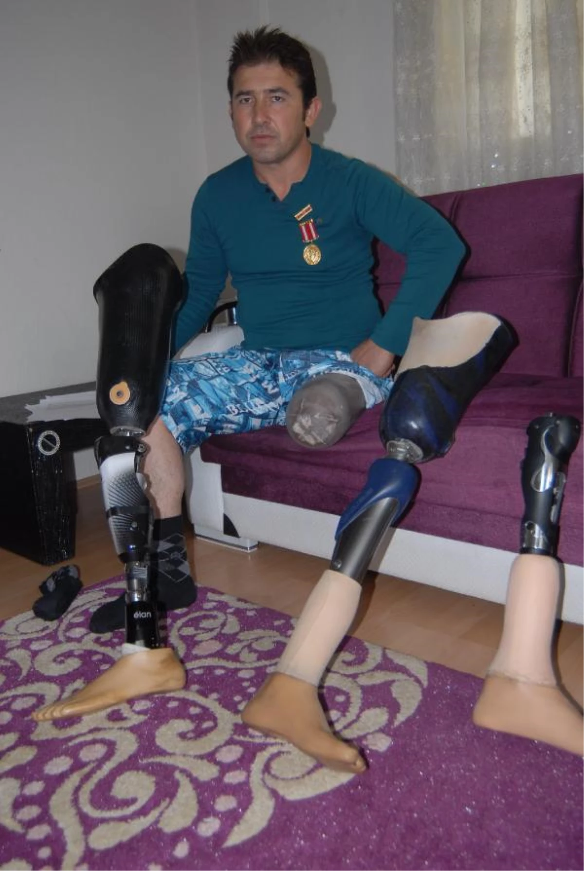 Gazinin Protez Bacağına Haciz
