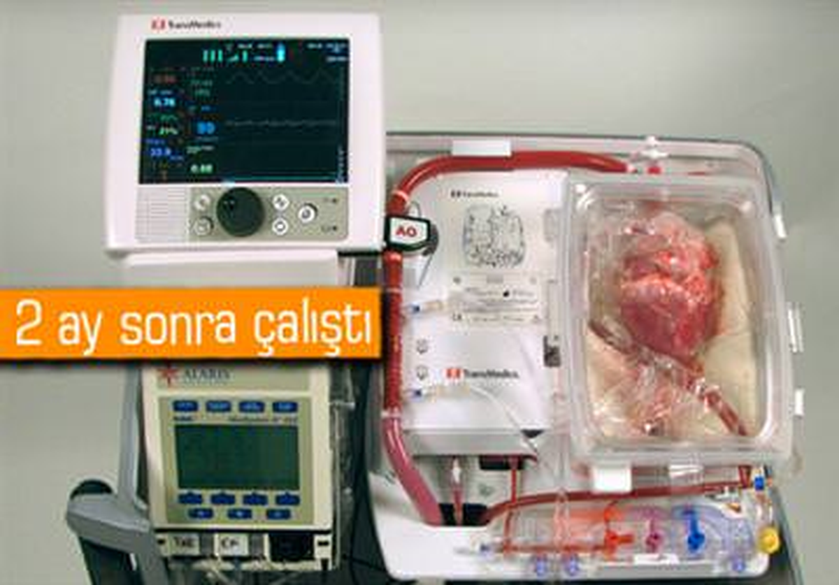 Doktorlar Hastaya \'Ölü Kalp\' Nakli Yaptı, Kalp Çalıştı