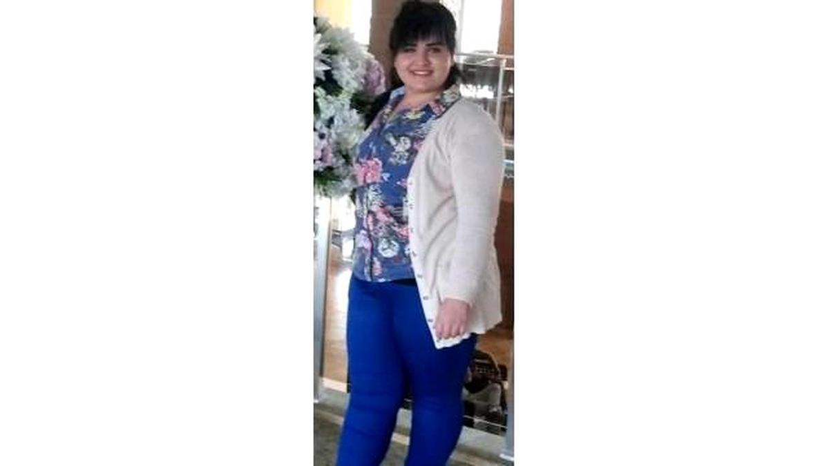 Mide Küçülttü, 110 Kilodan 65\'e Düştü
