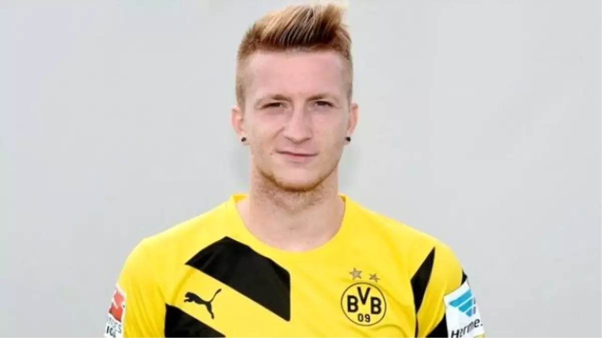 Dortmund\'lu Reus\'un Ayağı Feci Halde