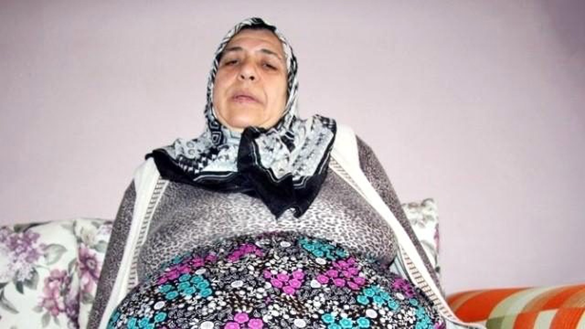 Bağırsakları Dışarıda Geziyor