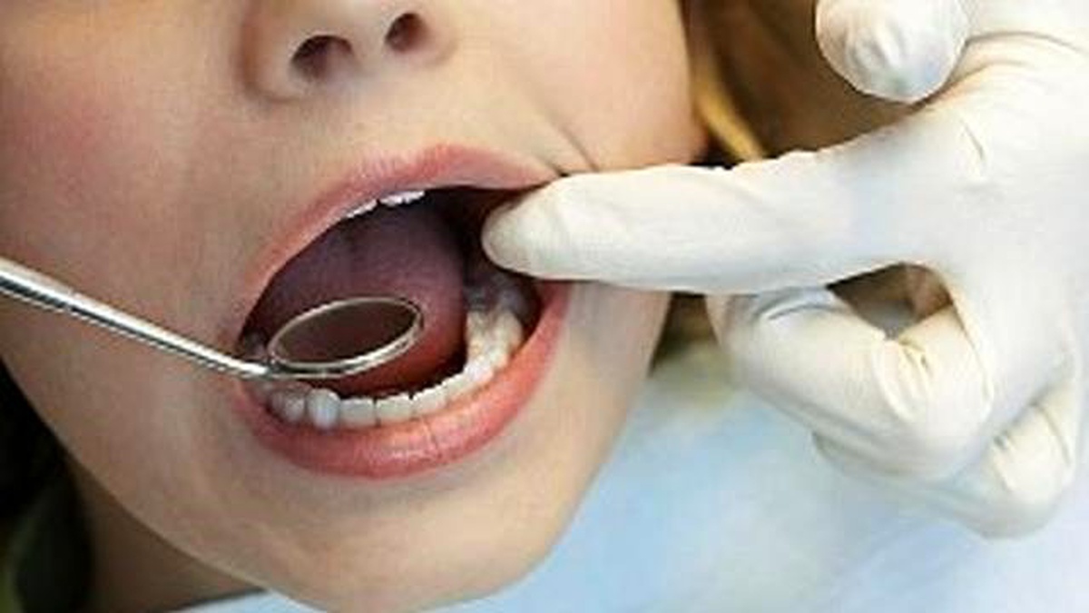 Engelli Öğrenciler Diş Taramasından Geçirilecek