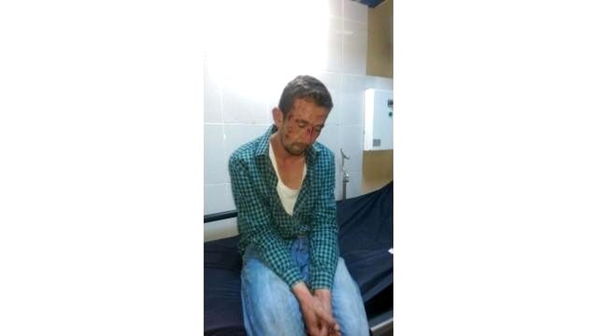 Polisten Kaçan Sürücü, 2 Polisin Yaralanmasına Neden Oldu