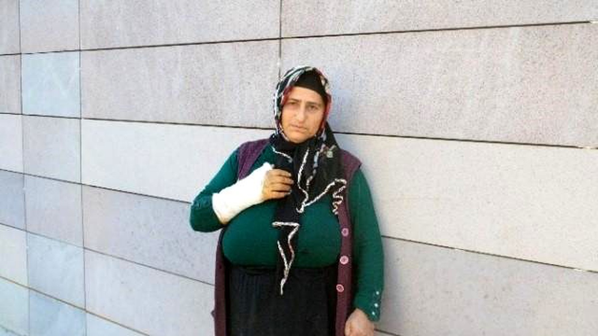 Köpek Tarafından Isırılan Kadın Hastanelik Oldu
